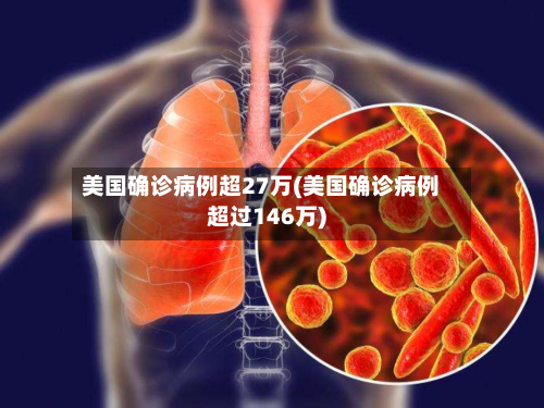 美国确诊病例超27万(美国确诊病例超过146万)-第3张图片